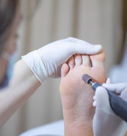 urejaje nohtov pri pedikuri