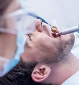 Samoplačniška endodontija Novo mesto