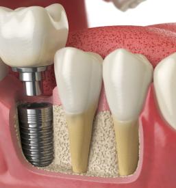 Odlična samoplačniška ordinacija Ptuj