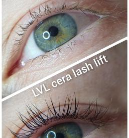 Vihanje trepalnic Domžale