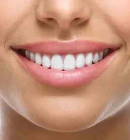 Nevidni zobni aparat Invisalign Celje