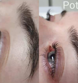 Naravno vihanje trepalnic Domžale