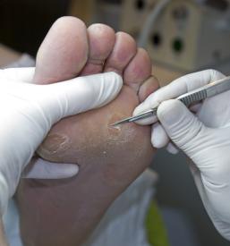 Izobraževanje o medicinski pedikuri