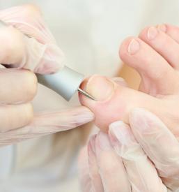 Urejanje nohtov na nogah