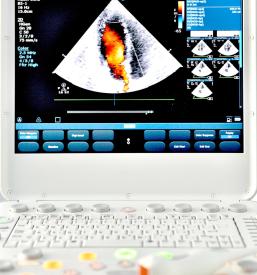 Ugoden pregled z ultrazvokom Sevnica