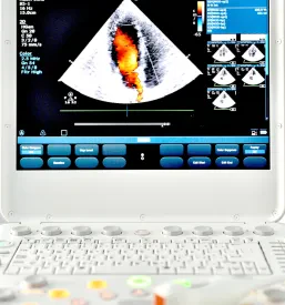 Ugoden pregled z ultrazvokom Sevnica