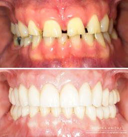 Najboljši zobozdravnik na koncesijo Ljubljana