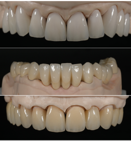 Zobotehnični laboratorij Ljubljana