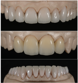 Zobotehnični laboratorij Ljubljana