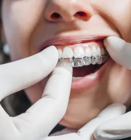 Ugoden Invisalign diamond provider Slovenija