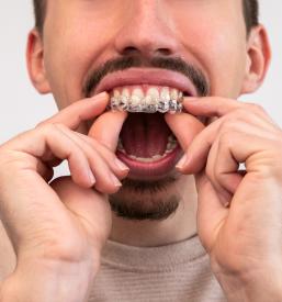 Dober Invisalign diamond provider Slovenija