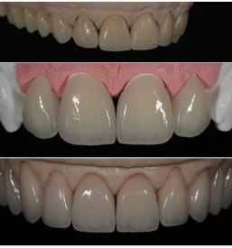 Laboratorij za protetiko Ljubljana