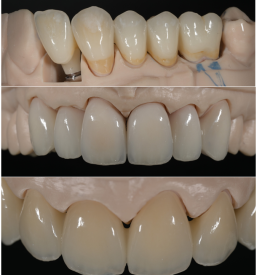 Zobotehnični laboratorij za protetiko Ljubljana