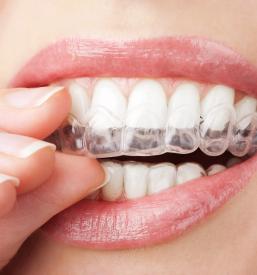 Najboljši Invisalign diamond provider Slovenija