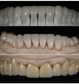 Laboratorij za zobno protetiko