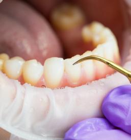 Zobozdravnik Tržič, Gorenjska