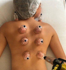 Naravna hidžama terapija Domžale