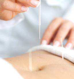 Terapija z akupunkturo Goriška