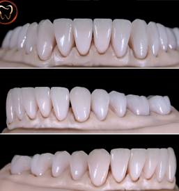 zobotehnični laboratorij Ljubljana