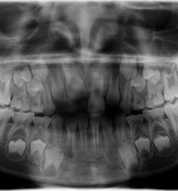Zobni rentgen v Ljubljani