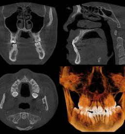 Zobni rentgen center Ljubljane