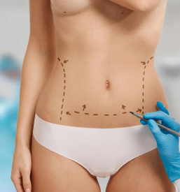 Plastična kirurgija Celje, Savinjska