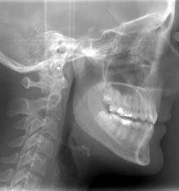 Zobni rentgen Ljubljana, center