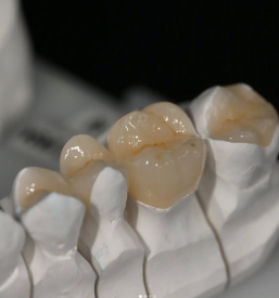 Estetski zobotehnični laboratorij Ljubljana