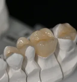 Estetski zobotehnični laboratorij Ljubljana