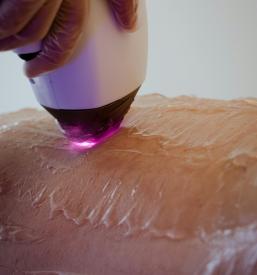 Odstranjevanje dlak z laserjem Osrednja Slovenija