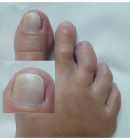 Dober pediker Nova Gorica