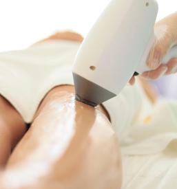 Lasersko odstranjevanje dlak Notranjska in Osrednja Slovenija