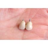 LUKA-DENT, zobotehnični laboratorij