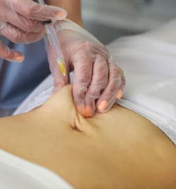 Lepotni posegi Celje