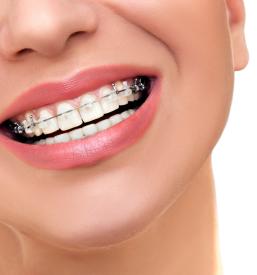 Dober samoplačniški ortodont Ljubljana