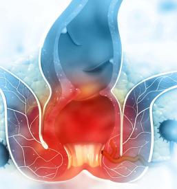 Odprava kandide Dolenjska