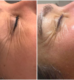 Nega obraza Nova Gorica