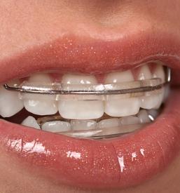 Ugodno estetsko zobozdravstvo Savinjska