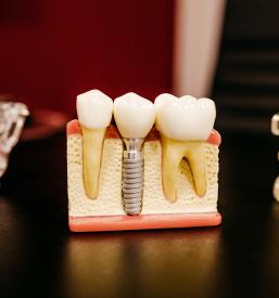 Najboljši zasebni zobozdravnik Gorenjska