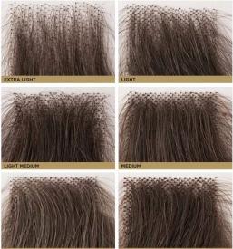 Lasna protetika Primorska, Slovenija