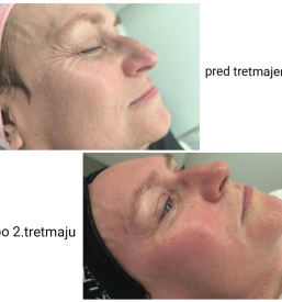 Kozmetične storitve Dravograd