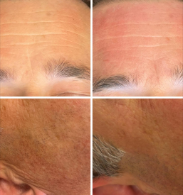 Nega kože v Novi Gorici