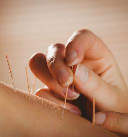 Kvalitetna akupunktura v Posavju