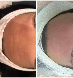 Strokovni lepotni obrazni tretmaji v Novi Gorici