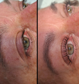 Nega trepalnic Ljubljana center