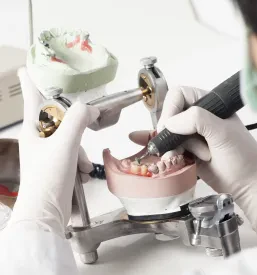 3D tisk dentalnih konstrukcij Slovenija