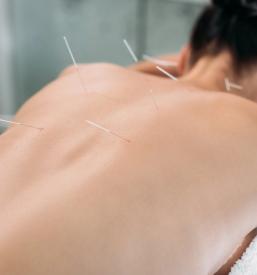 Kvalitetna akupunktura Posavje