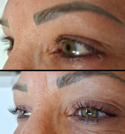 Vvig trepalnic Ljubljana