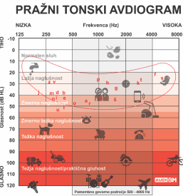 Prodaja slušnih aparatov Ljubljana, Slovenija