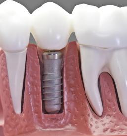 Privat zobozdravnik Kranj